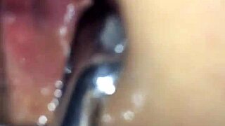 Shemale speculum anal