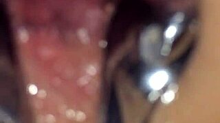 Shemale speculum anal