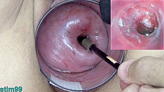 In this bizarre extreme scene, a mature Japanese milf undergoes cervix play with an endoscope camera inserted into her uterus
