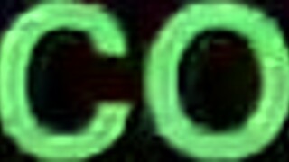 Hairy queen with glasses fingers wet pussy using dildo on webcam again